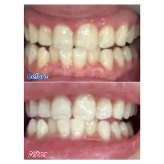 MBEAUTYSALON 千葉店・京成大久保所属・Melty 輝のその他イメージ