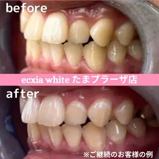 セルフホワイトニング　エクシアたまプラーザ店所属・yukari - オーナー -のその他イメージ