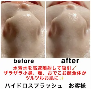 ネイル・エステサロン UILANIのネイルデザイン