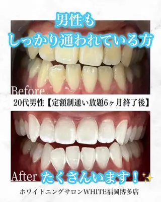 メンズ キッズ セルフホワイトニング WHITE福岡博多店のエステ・リラクイメージ