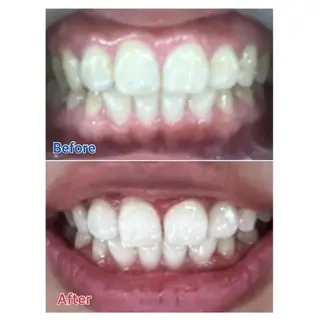 M渋谷 ホワイトニングのエステ・リラクイメージ