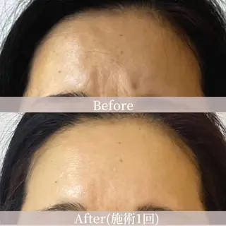 綺麗のひみつ グランプリ受賞店のエステ・リラクイメージ