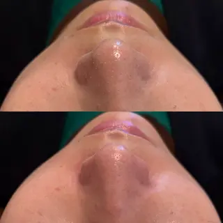 LUMIERE 福岡のエステ・リラクイメージ