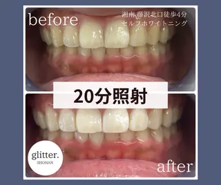マツエク・マツパ glitter.SHONAN所属・ホワイトニング専門店 glitterのその他イメージ