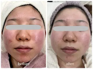 エステティックサロン ベルネのエステ・リラクイメージ