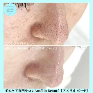 毛穴ケア専門サロン アメリオボーテのその他イメージ