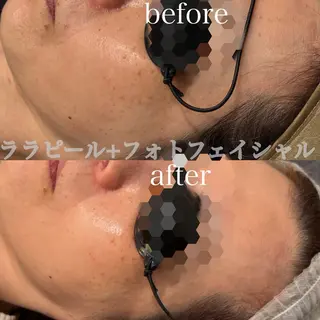 Esthetic ReTweetのエステ・リラクイメージ