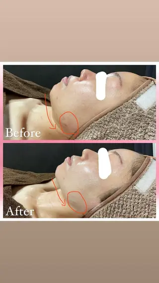 salon〜RePCa〜(サロンルピカ)所属・山﨑 藍のエステ・リラクイメージ