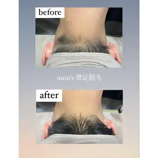 【韓国肌管理・脱毛】 クレセントのその他イメージ