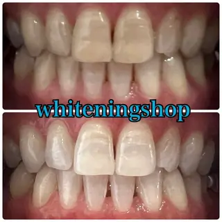 ホワイトニング ショップ津店のその他イメージ