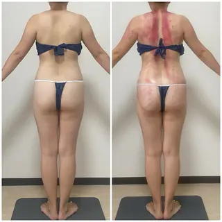 セルライトクラッシュ ＆腸もみ＋骨盤矯正のその他イメージ