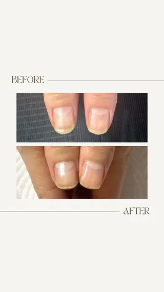 ネイル fote-自爪育成 ネイルケアサロン-のネイルデザイン