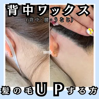 毛穴レス ハーブ＆ ワックス脱毛×光脱毛のエステ・リラクイメージ