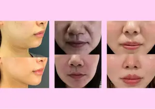 愛維美水光美肌専門店所属・愛維美水光美肌専門店 メンズレディースokのエステ・リラクイメージ