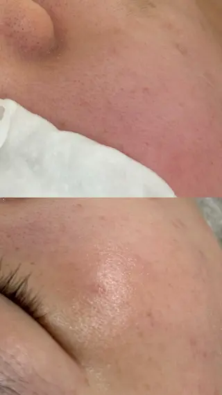 琥空 -KOA-のネイルデザイン