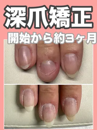 ネイル nail salon petillantのネイルデザイン
