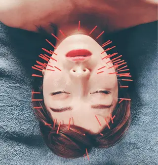 美容鍼専門 ハリエンジュのエステ・リラクイメージ