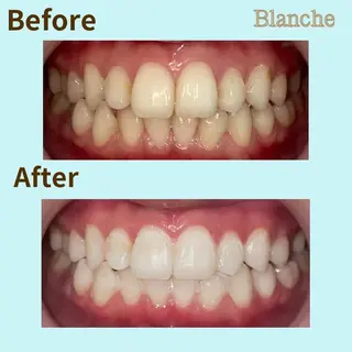 Blanche 心斎橋のその他イメージ