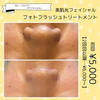 yellow💛【 脱毛&フェイシャル】のエステ・リラクイメージ