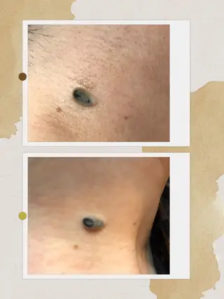 ヌーベル プリュムのその他イメージ