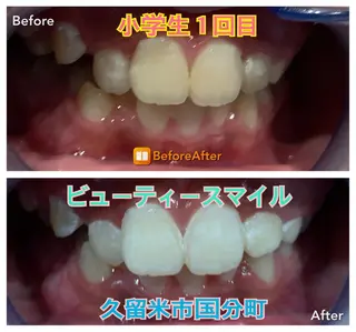 メンズ キッズ アイリンダ ビューティーのエステ・リラクイメージ