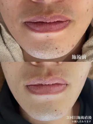 メンズ muumo所属・muumo まりののエステ・リラクイメージ