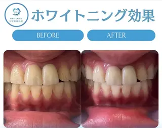 韓国式ホワイトニング R24大阪梅田店のその他イメージ