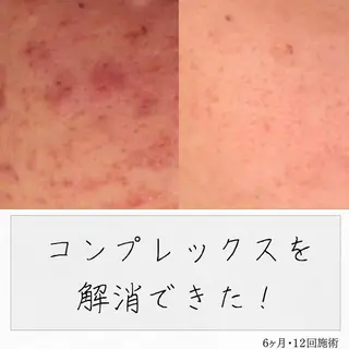 ニキビ経験者が施術 する専門サロン🌻のエステ・リラクイメージ