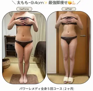 《本気痩せ×疲労改善 》  BILOOPのエステ・リラクイメージ