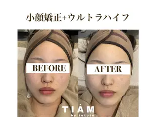 美肌サロンTIAM by tetoteのエステ・リラクイメージ