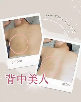 美肌サロン💎ハーブ ピーリング🌿ルプレのエステ・リラクイメージ