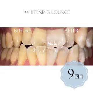 ホワイトニング Lounge横須賀のエステ・リラクイメージ