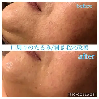 ロング カラー パーマ ヘアアレンジ メンズ キッズ ネイル マツエク・マツパ EnsorClair 代表　野口真央のエステ・リラクイメージ