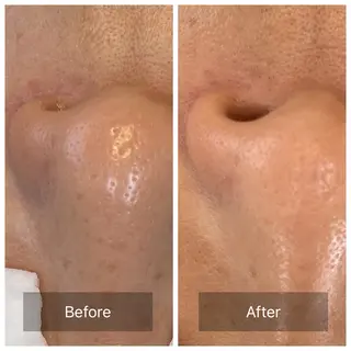 facial aesthetic salon SENTEUR所属・美肌改善/毛穴/シミ サントゥールのエステ・リラクイメージ