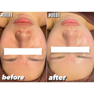 EMILU CAのエステ・リラクイメージ