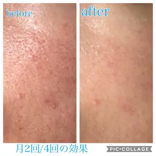ミディアム カラー パーマ ヘアアレンジ キッズ ネイル マツエク・マツパ EnsorClair 代表 野口真央のエステ・リラクイメージ