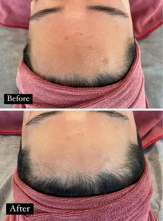 ニキビ/疲労回復ケア シェソワのエステ・リラクイメージ