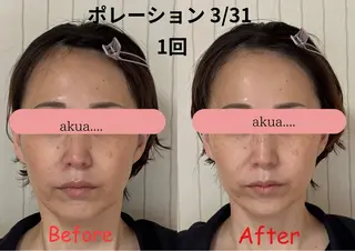 akua... 【肌質管理専門】のその他イメージ