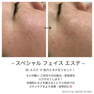 ビューティー ミロワールのエステ・リラクイメージ