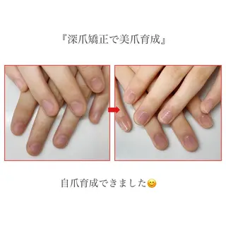 ネイル ネイルサロン アリュームのネイルデザイン