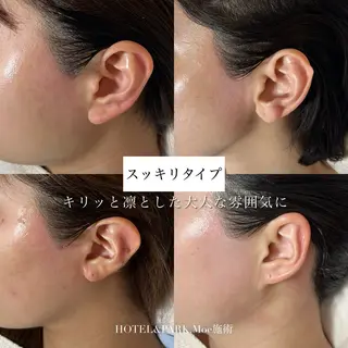 HOTEL&PARK .Moeワックス脱毛のエステ・リラクイメージ