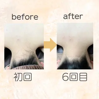 脱毛専門店 Angemのエステ・リラクイメージ