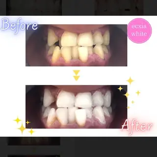 nanami -ホワイトニングのその他イメージ