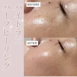 プライベートサロン Belle（ベル）のエステ・リラクイメージ