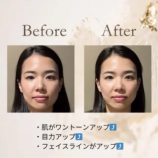 健康×美容鍼鍼灸院 あさば整骨院南流山店のエステ・リラクイメージ