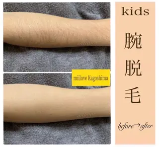 キッズ miilove 鹿児島店のエステ・リラクイメージ