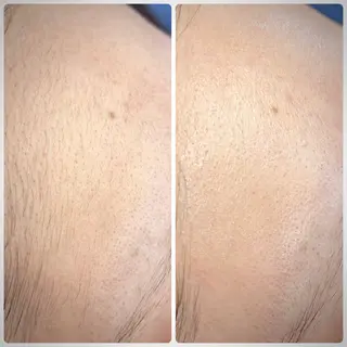 Muqu.所属・Muqu. 毛穴サロンのエステ・リラクイメージ