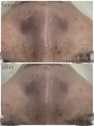Amily beauty 毛利のエステ・リラクイメージ