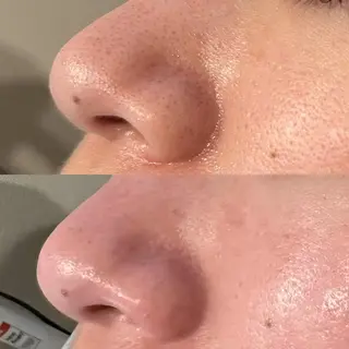 韓国系得意🦋 Aspire.のマツエク・マツパデザイン