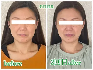 三上 笑里奈のエステ・リラクイメージ